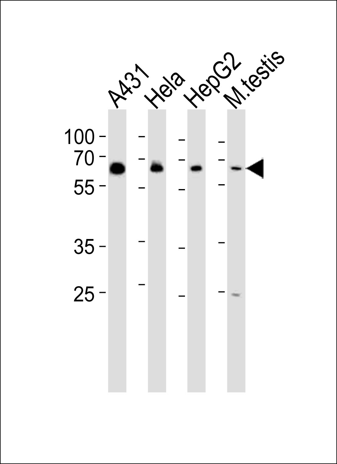 WB - EHD4 Antibody (C-term) AP20790c